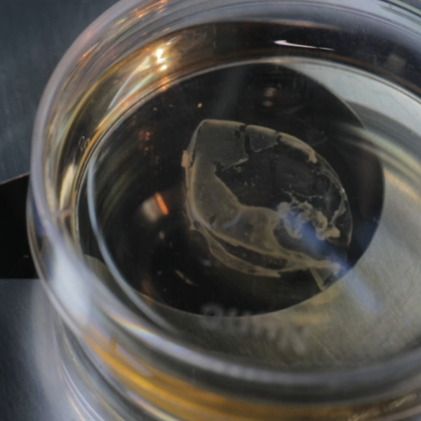 2026: The Dawn of Regenerative Medicine — Accelerating Cell Therapy and the Rise of iPSC Technology