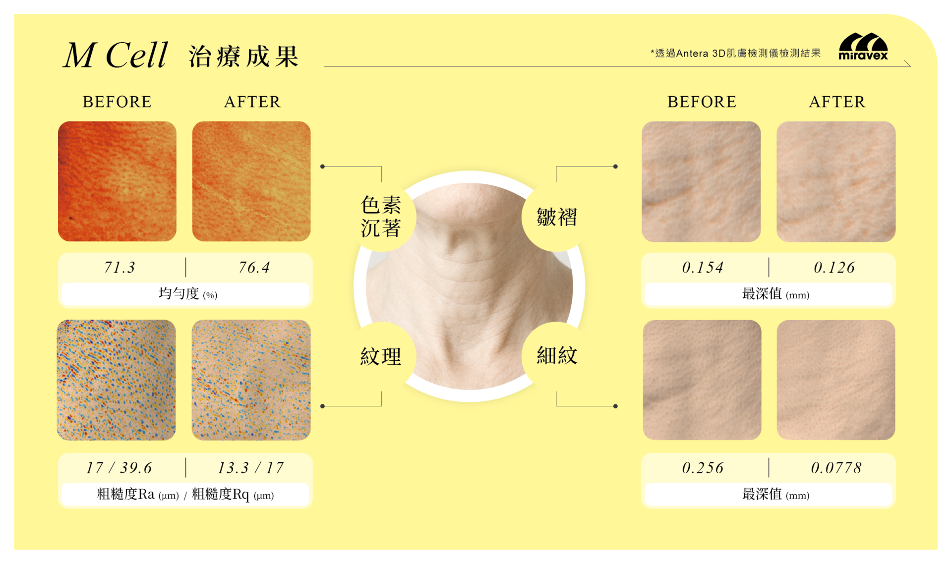 ALL_technology_25J02_kr0EE16L45